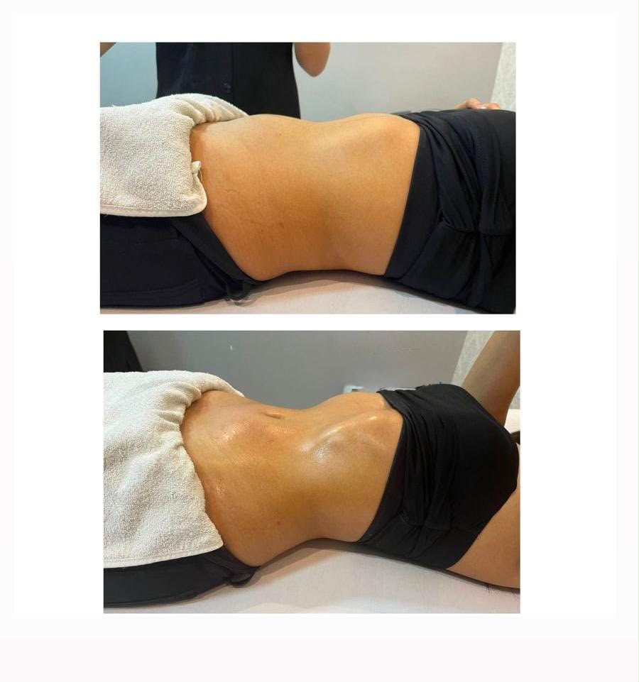 Massagem Modeladora na Virtuosa Porto Alegre Zona Norte
